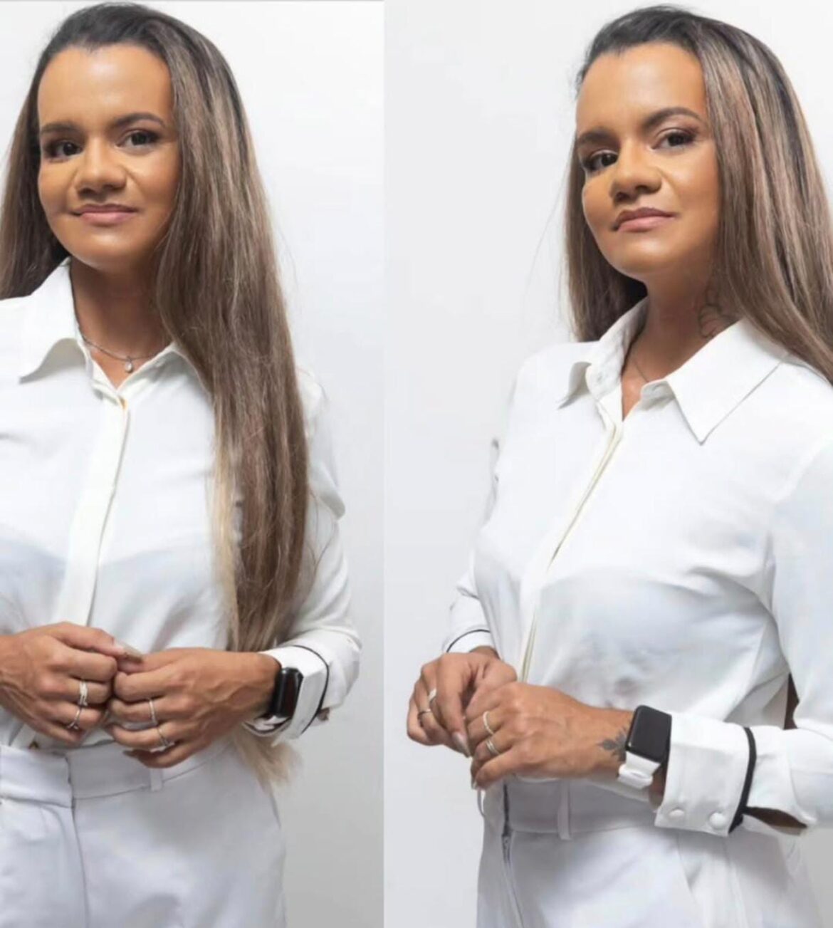 Juliana Garcia reaparece nas redes e emociona o país após cirurgia reconstructiva bem-sucedida